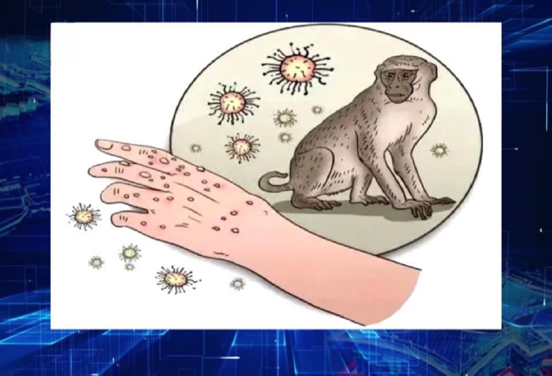 Hva du trenger å vite om Monkeypox Virus?
