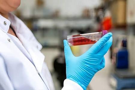 Virus Transport Kit (ikke-inaktivert)-Sikker viral prøveinnsamling