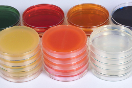 Triple Sugar Iron Agar (TSI): Nøyaktig differensiering av enterisk baciller med Babio