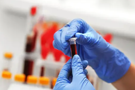 Rask malariadeteksjon: BABIOs doble antigentestsett styrker global helse