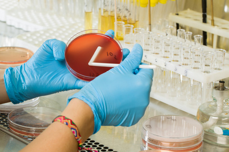 BABIOs MacConkey Agar Medium – Premium selektiv isolasjon for global mikrobiologisk diagnostikk