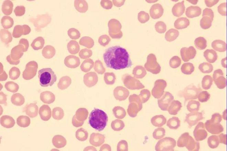 Grisparatyfusvaksinemedium for produksjon av veterinærvaksine